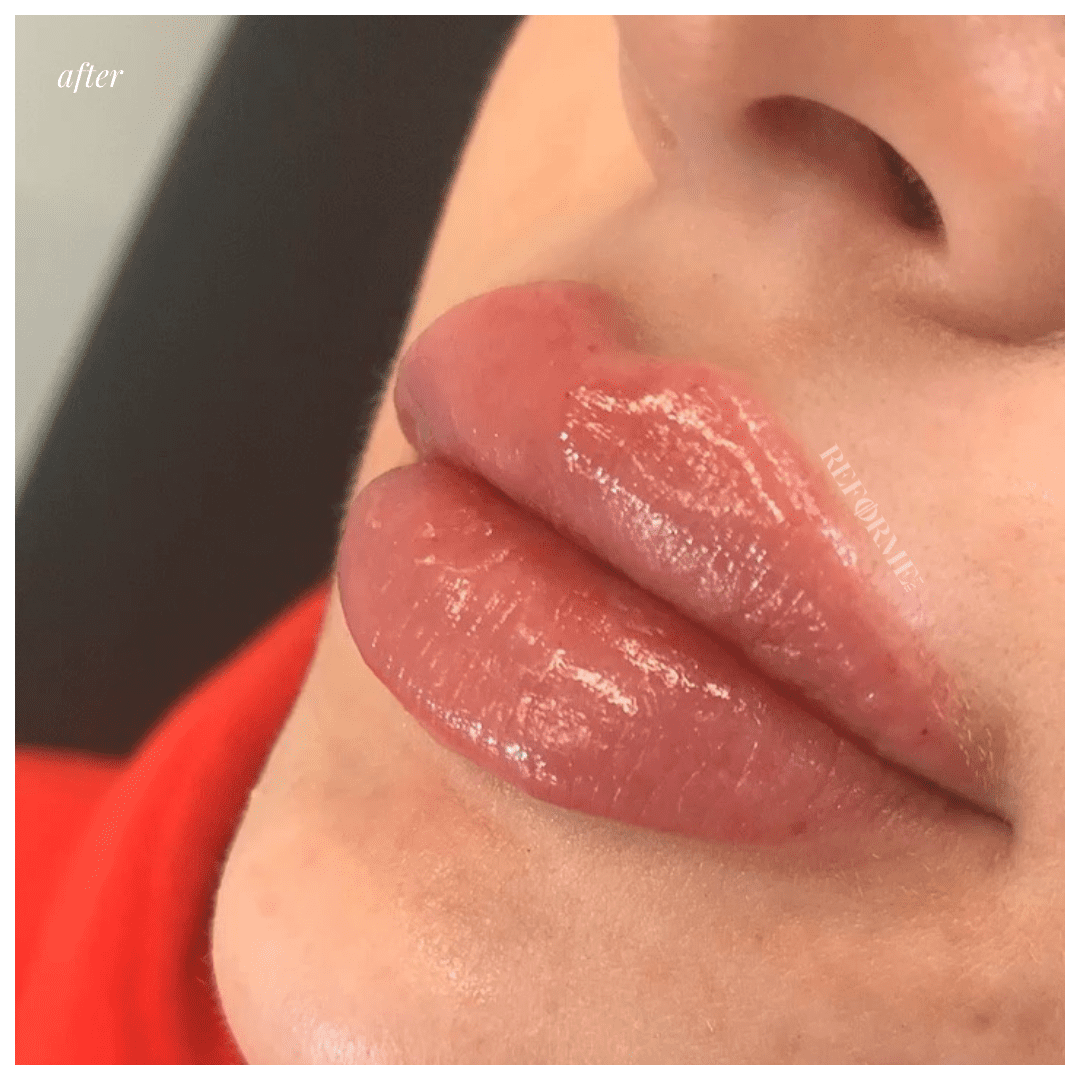 Reforme Lab|Lip Plump Landing Page