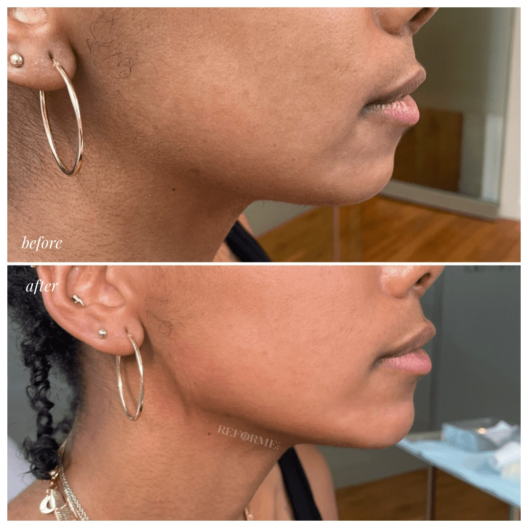 reforme lab medical the best injectable