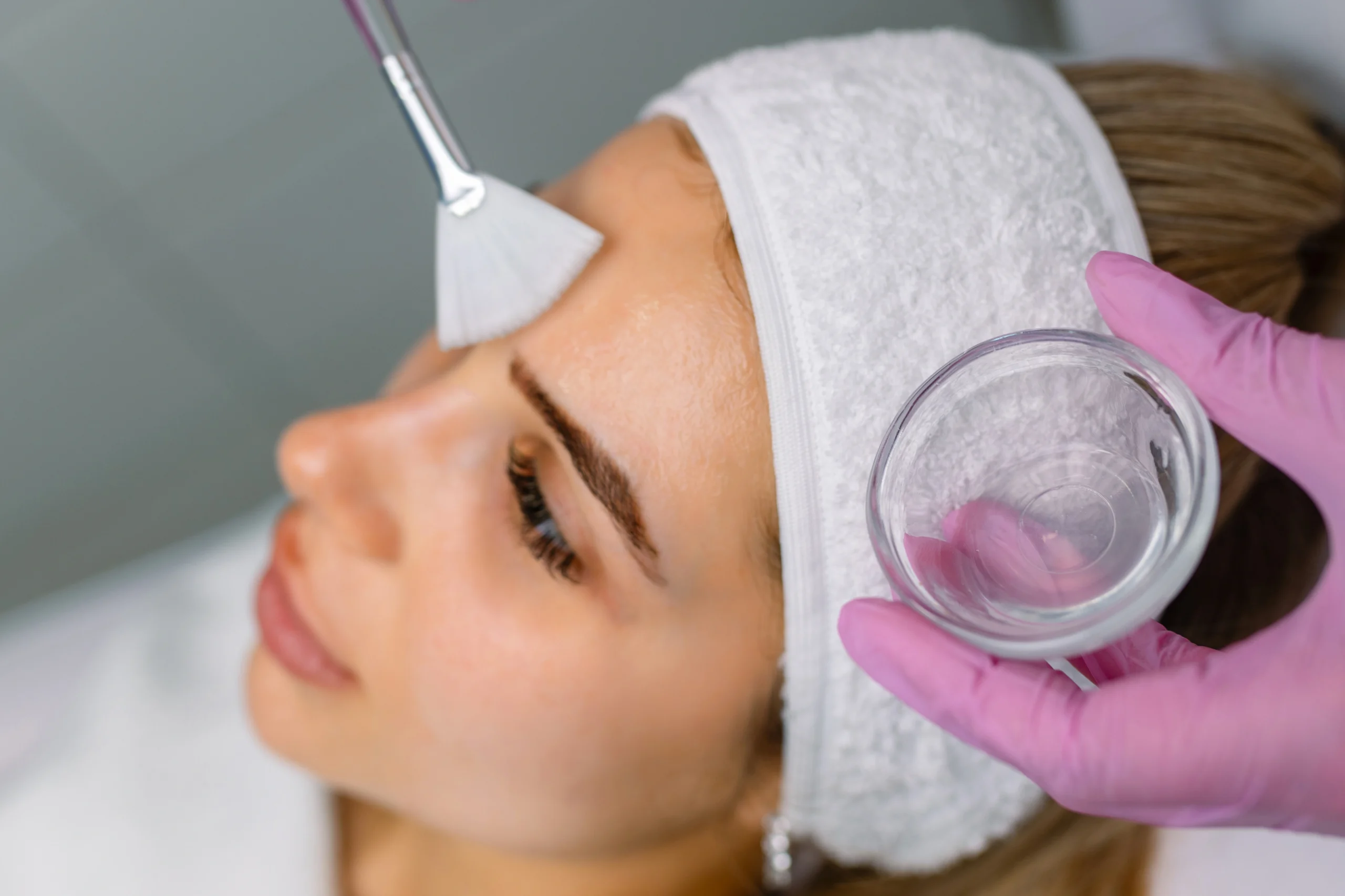 ZO chemical peel GTA