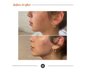 facial restructuring services in brampton