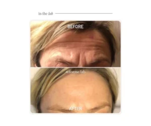 facial treatment vaughan