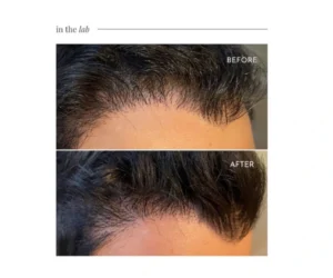 hair treatment markham