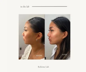 jaw restructuring vaughan