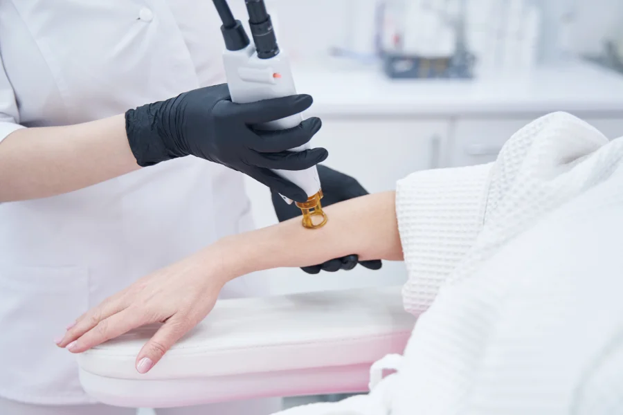 laser hair removal near me