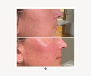 pickering facial services