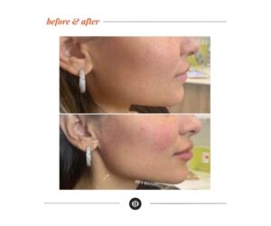 Reforme Lab beauty clinic Richmond Hill