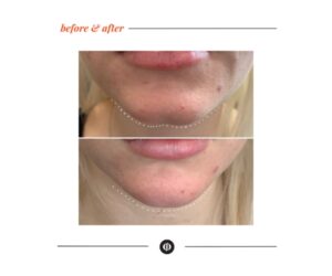 Reforme Lab beauty clinic Richmond Hill