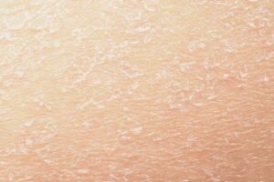 best ingredients for dry skin